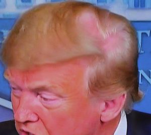 Donald Trump bald head
